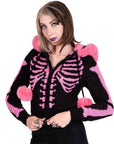 Cardigan in pelliccia rosa Bony Rib Cage Skelly